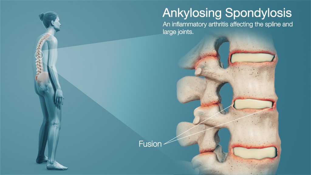 best spine treatment in amritsar