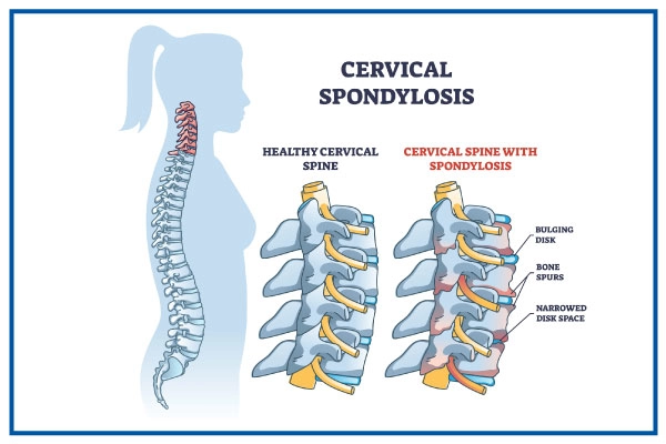 cervical treatment in amritsar