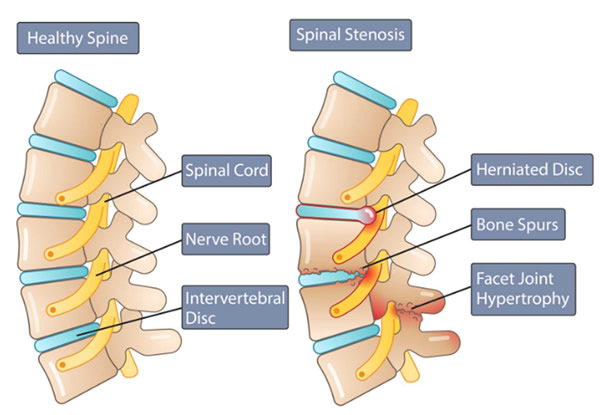 best spine treatment in amritsar